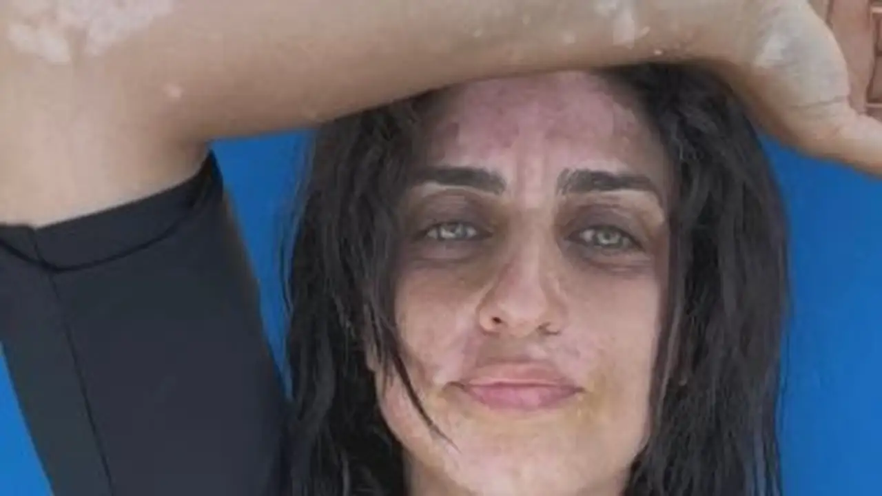 دعم مؤثر.. أمير كرارة يساند شقيقته في مكافحة البهاق